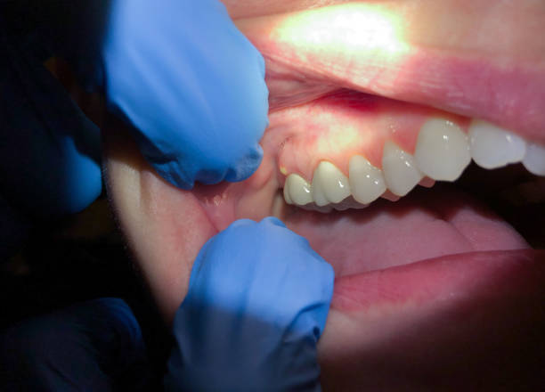 Best Emergency Gum Pain Relief  in Sallisaw, OK